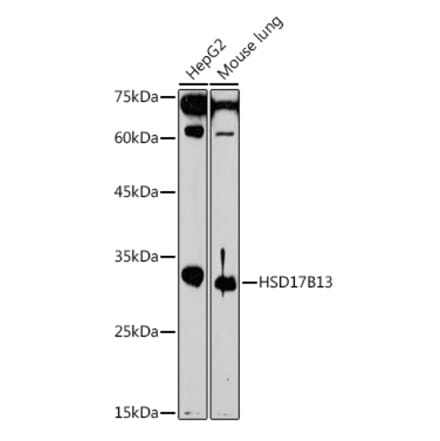 Western Blot - Anti-HSD17B13 Antibody (A15134) - Antibodies.com