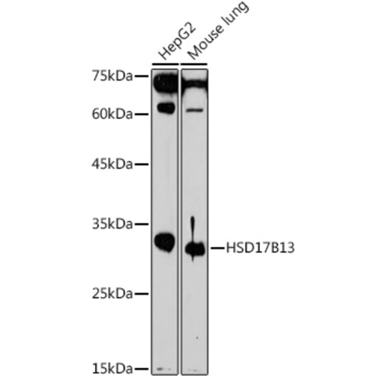 Western Blot - Anti-HSD17B13 Antibody (A15134) - Antibodies.com