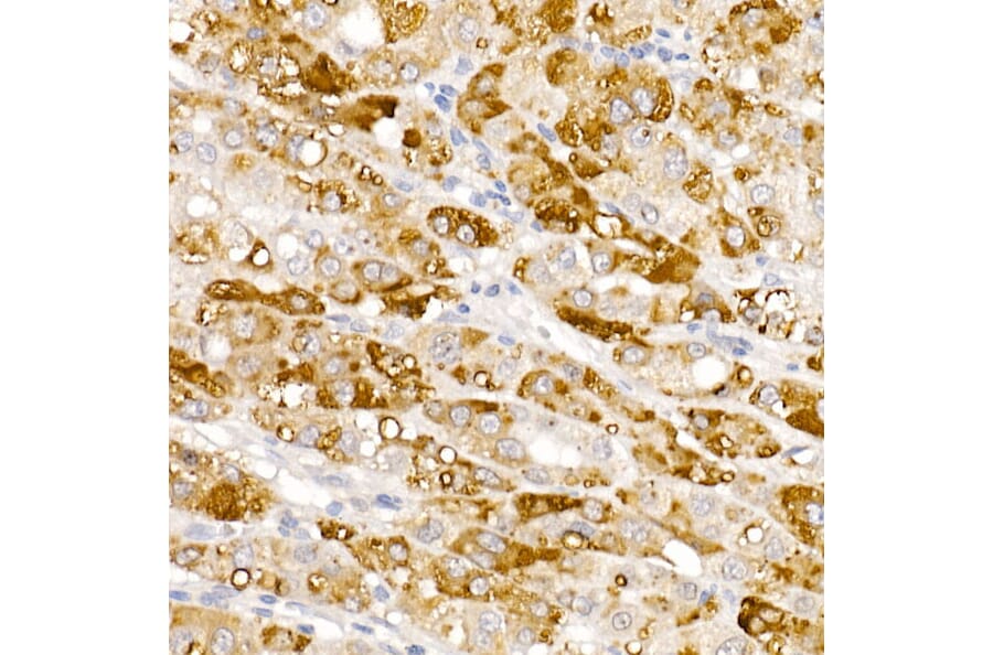 Immunohistochemistry - Anti-HSD17B13 Antibody (A15134) - Antibodies.com