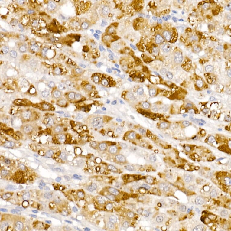 Immunohistochemistry - Anti-HSD17B13 Antibody (A15134) - Antibodies.com