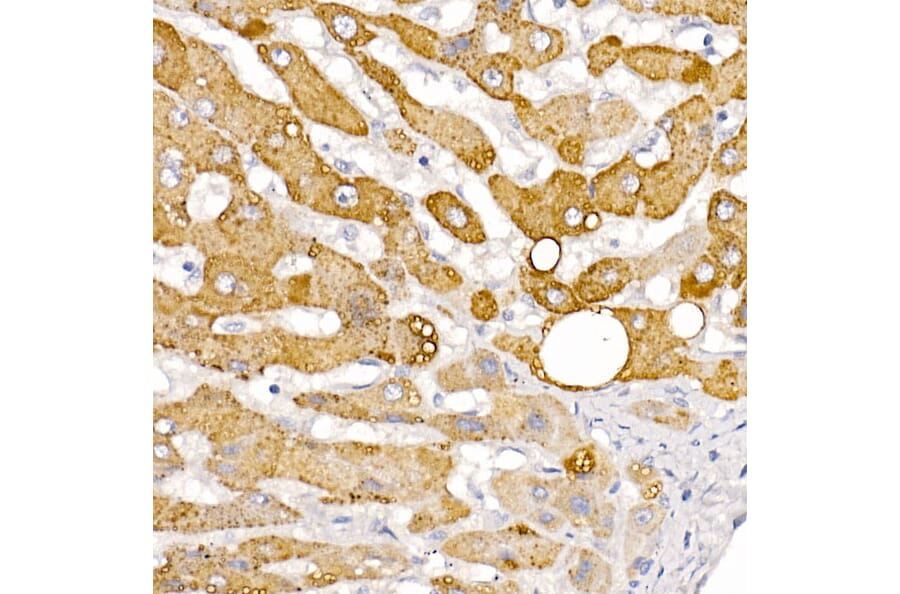Immunohistochemistry - Anti-HSD17B13 Antibody (A15134) - Antibodies.com