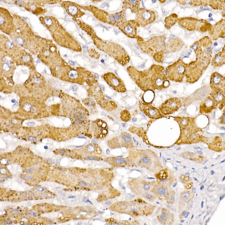 Immunohistochemistry - Anti-HSD17B13 Antibody (A15134) - Antibodies.com