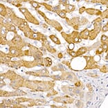 Immunohistochemistry - Anti-HSD17B13 Antibody (A15134) - Antibodies.com