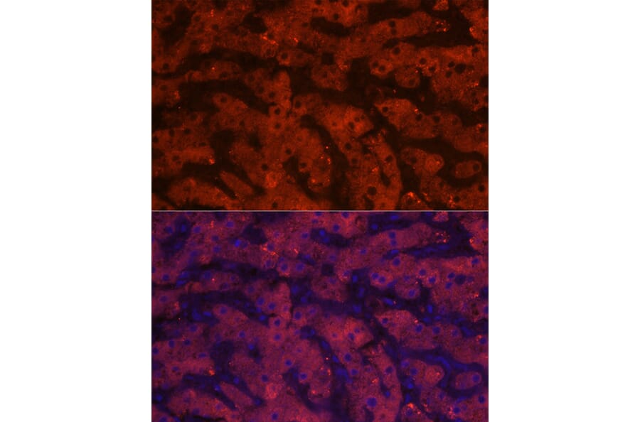 Immunofluorescence - Anti-HSD17B13 Antibody (A15134) - Antibodies.com