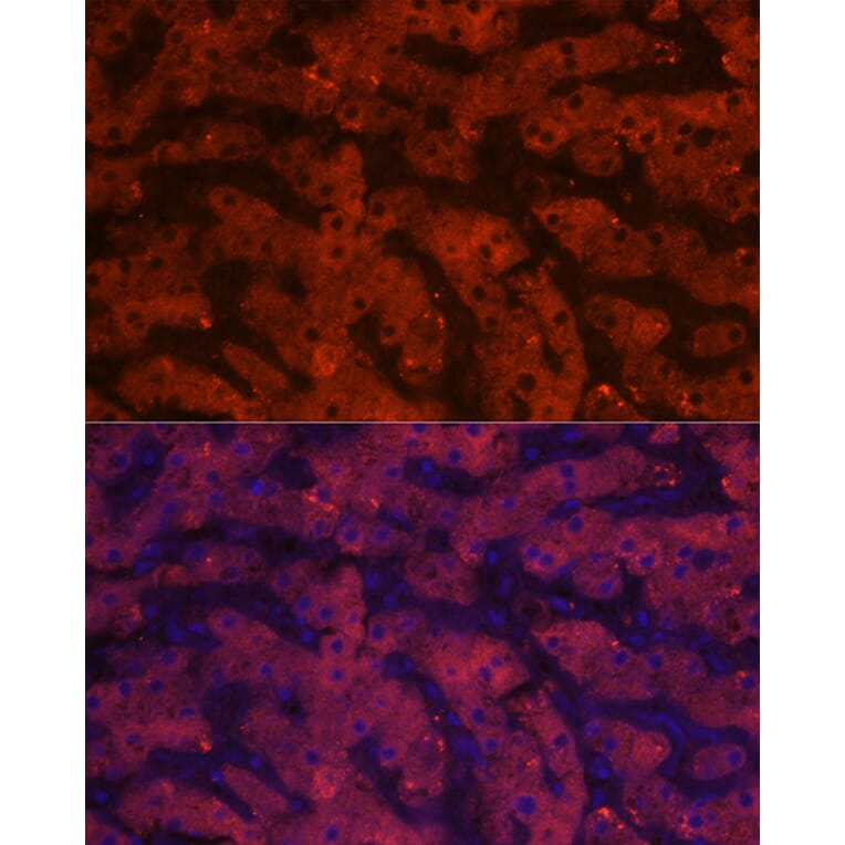 Immunofluorescence - Anti-HSD17B13 Antibody (A15134) - Antibodies.com