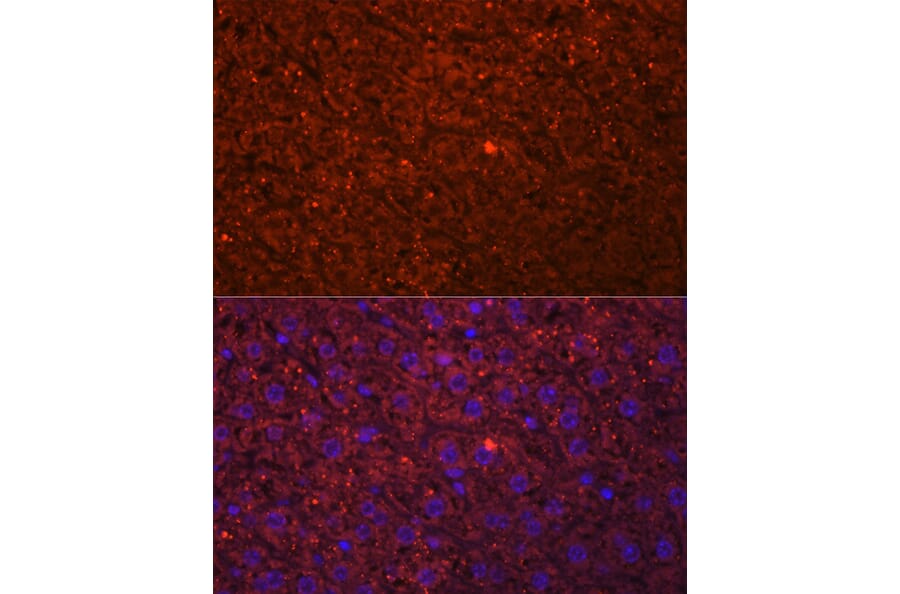 Immunofluorescence - Anti-HSD17B13 Antibody (A15134) - Antibodies.com