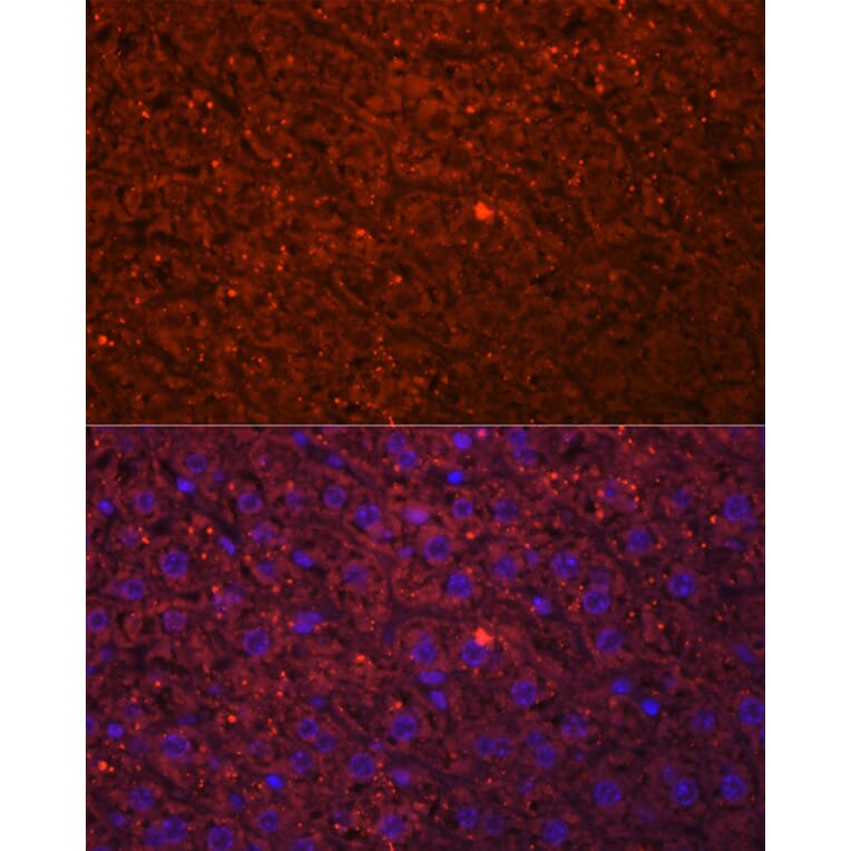 Immunofluorescence - Anti-HSD17B13 Antibody (A15134) - Antibodies.com