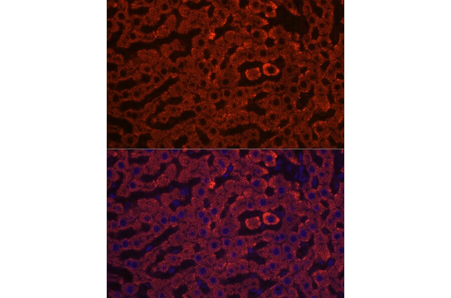 Immunofluorescence - Anti-HSD17B13 Antibody (A15134) - Antibodies.com