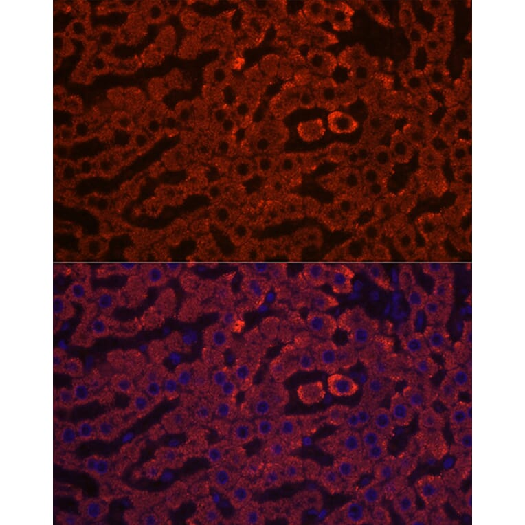 Immunofluorescence - Anti-HSD17B13 Antibody (A15134) - Antibodies.com