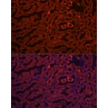 Immunofluorescence - Anti-HSD17B13 Antibody (A15134) - Antibodies.com