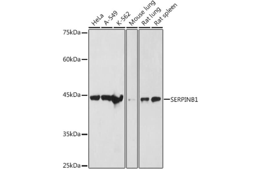 Western Blot - Anti-SERPINB1/PI2 Antibody (A15135) - Antibodies.com