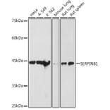 Western Blot - Anti-SERPINB1/PI2 Antibody (A15135) - Antibodies.com