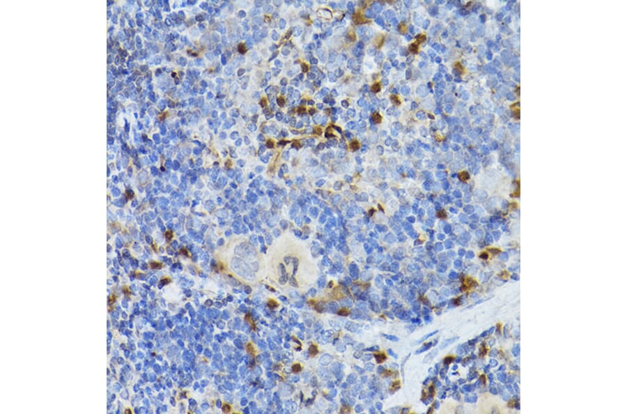 Immunohistochemistry - Anti-SERPINB1/PI2 Antibody (A15135) - Antibodies.com