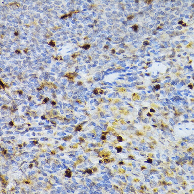 Immunohistochemistry - Anti-SERPINB1/PI2 Antibody (A15135) - Antibodies.com