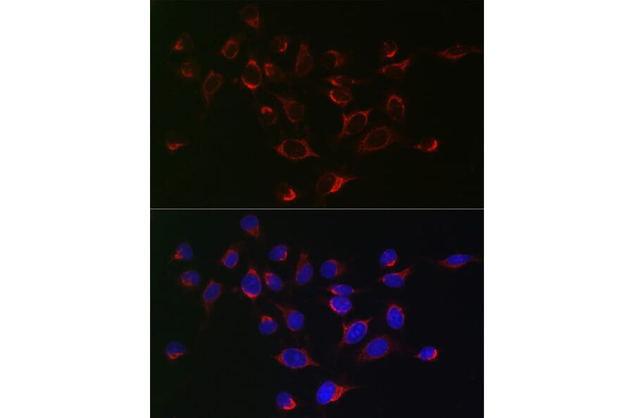 Immunofluorescence - Anti-SERPINB1/PI2 Antibody (A15135) - Antibodies.com