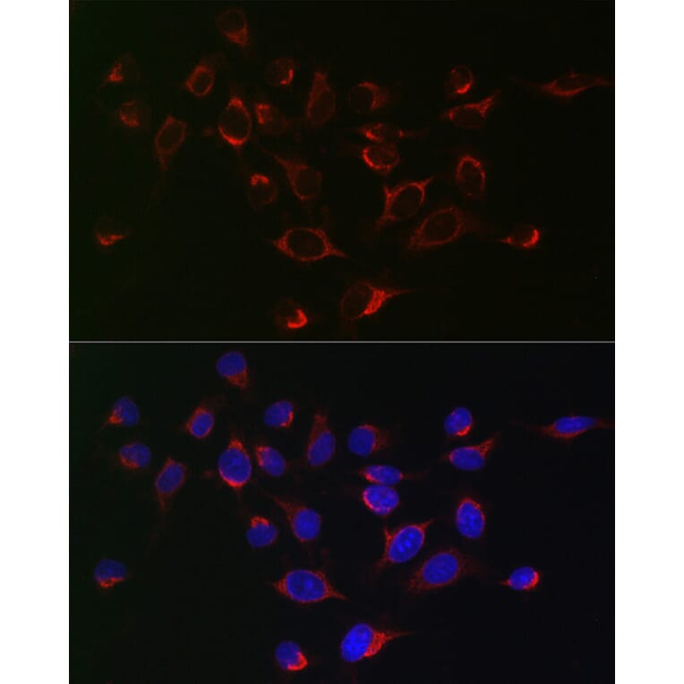 Immunofluorescence - Anti-SERPINB1/PI2 Antibody (A15135) - Antibodies.com