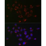 Immunofluorescence - Anti-SERPINB1/PI2 Antibody (A15135) - Antibodies.com