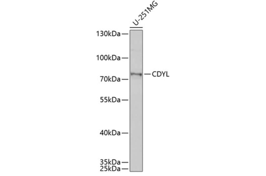 Western Blot - Anti-CDYL Antibody (A15136) - Antibodies.com