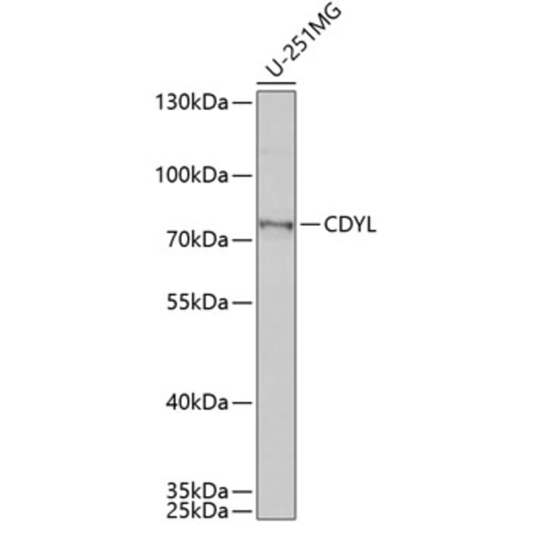 Western Blot - Anti-CDYL Antibody (A15136) - Antibodies.com