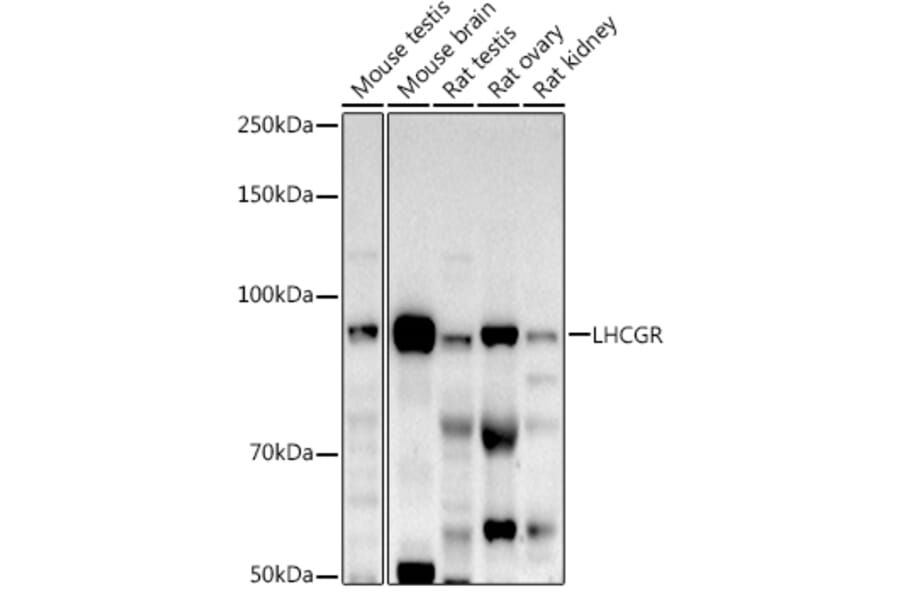 Western Blot - Anti-hCG receptor/LHR Antibody (A15138) - Antibodies.com