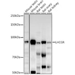 Western Blot - Anti-hCG receptor/LHR Antibody (A15138) - Antibodies.com