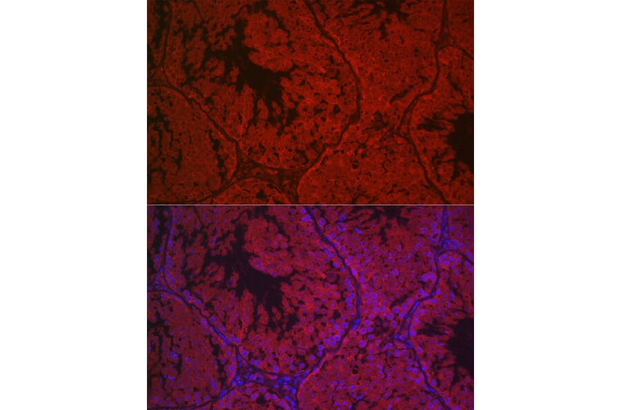 Immunofluorescence - Anti-hCG receptor/LHR Antibody (A15138) - Antibodies.com