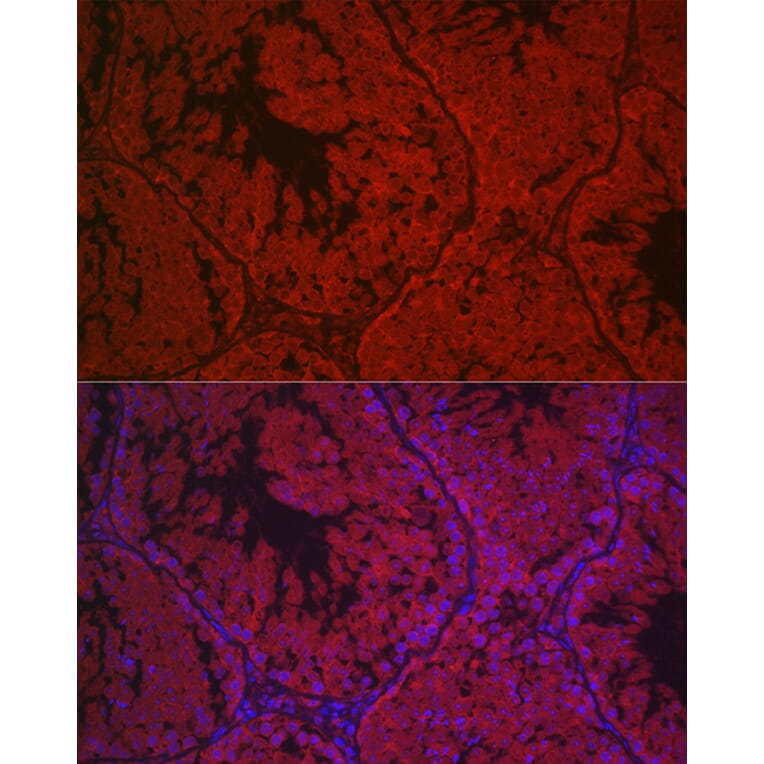 Immunofluorescence - Anti-hCG receptor/LHR Antibody (A15138) - Antibodies.com