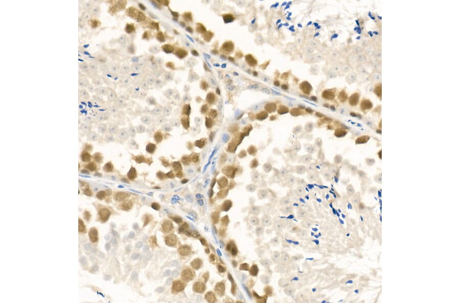 Immunohistochemistry - Anti-Rad51 Antibody (A15139) - Antibodies.com