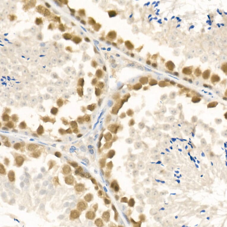 Immunohistochemistry - Anti-Rad51 Antibody (A15139) - Antibodies.com