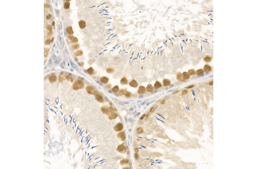 Immunohistochemistry - Anti-Rad51 Antibody (A15139) - Antibodies.com