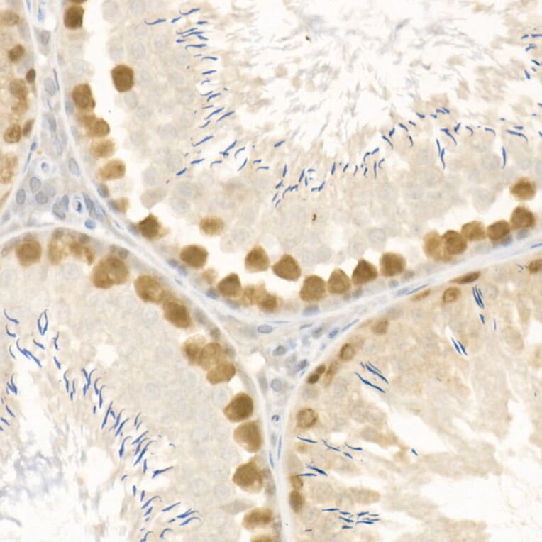 Immunohistochemistry - Anti-Rad51 Antibody (A15139) - Antibodies.com