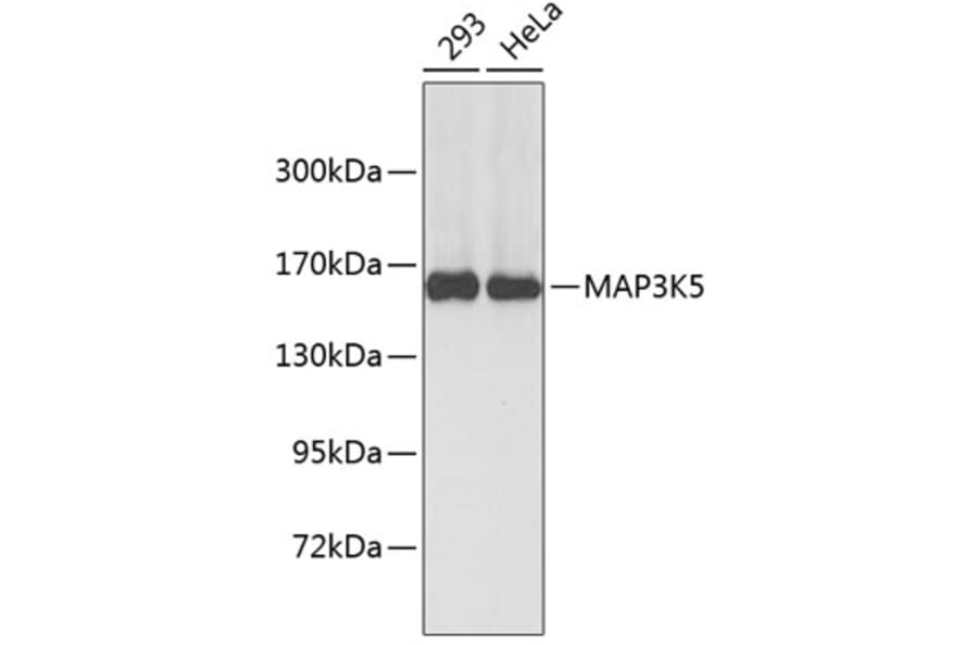 Western Blot - Anti-MAP3K5 Antibody (A6274) - Antibodies.com