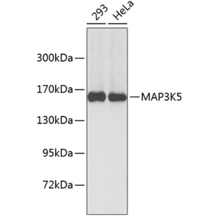 Western Blot - Anti-MAP3K5 Antibody (A6274) - Antibodies.com