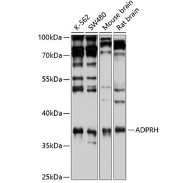 Western Blot - Anti-ADPRH Antibody (A15142) - Antibodies.com