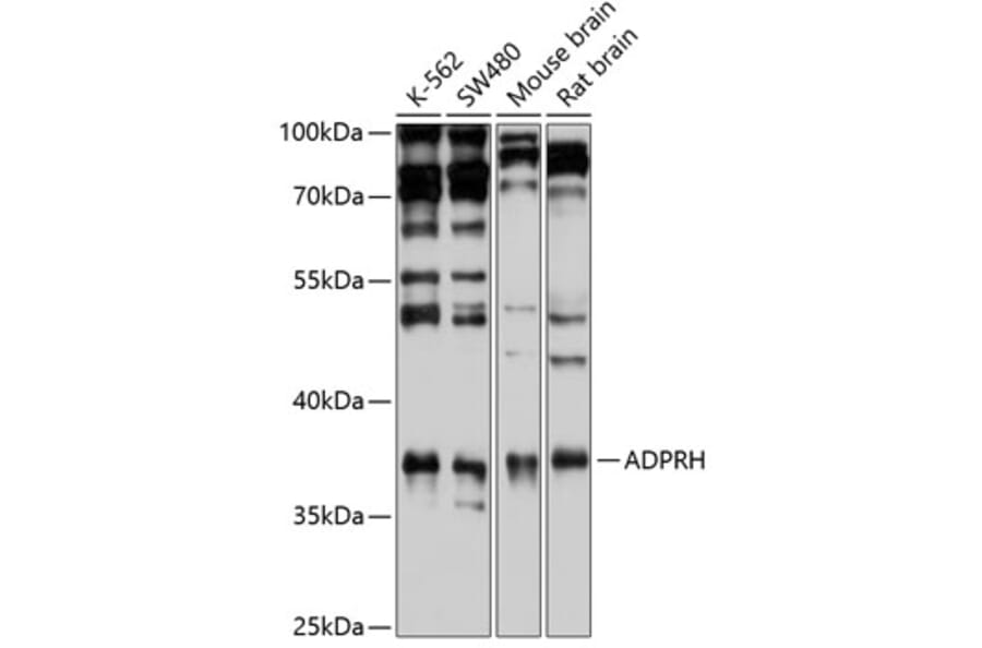 Western Blot - Anti-ADPRH Antibody (A15142) - Antibodies.com