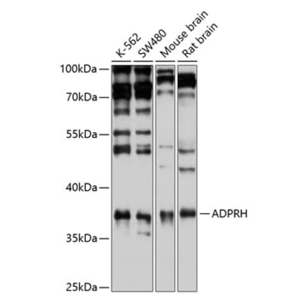 Western Blot - Anti-ADPRH Antibody (A15142) - Antibodies.com