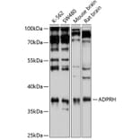 Western Blot - Anti-ADPRH Antibody (A15142) - Antibodies.com