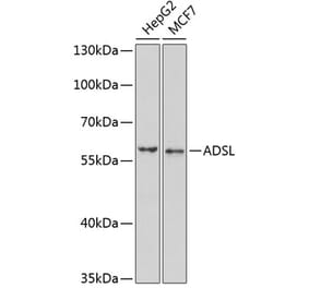 Western Blot - Anti-AMPS Antibody (A15143) - Antibodies.com