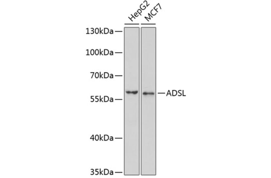 Western Blot - Anti-AMPS Antibody (A15143) - Antibodies.com