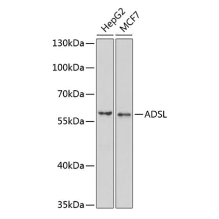 Western Blot - Anti-AMPS Antibody (A15143) - Antibodies.com
