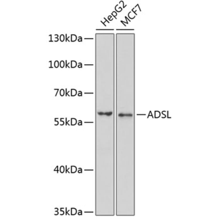 Western Blot - Anti-AMPS Antibody (A15143) - Antibodies.com