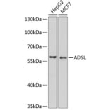 Western Blot - Anti-AMPS Antibody (A15143) - Antibodies.com