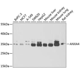 Western Blot - Anti-ANXA4 Antibody (A6280) - Antibodies.com