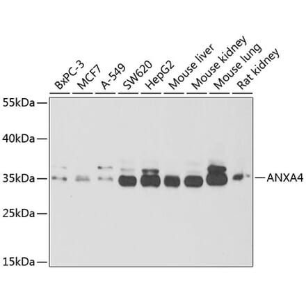 Western Blot - Anti-ANXA4 Antibody (A6280) - Antibodies.com