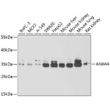Western Blot - Anti-ANXA4 Antibody (A6280) - Antibodies.com