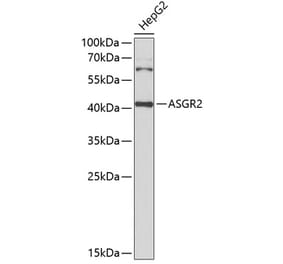 Western Blot - Anti-ASGR2 Antibody (A15146) - Antibodies.com