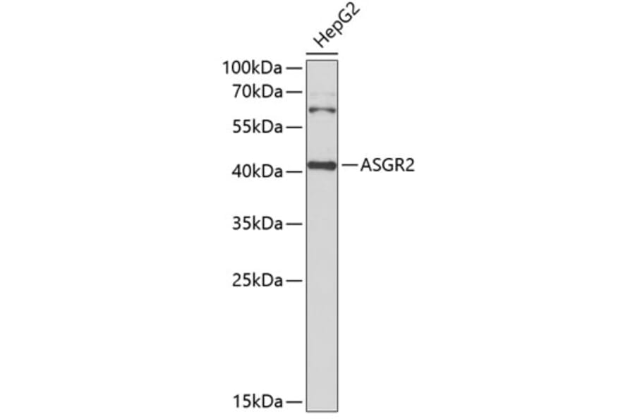 Western Blot - Anti-ASGR2 Antibody (A15146) - Antibodies.com