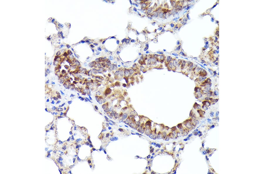 Immunohistochemistry - Anti-BNIP3L/NIX Antibody (A15147) - Antibodies.com