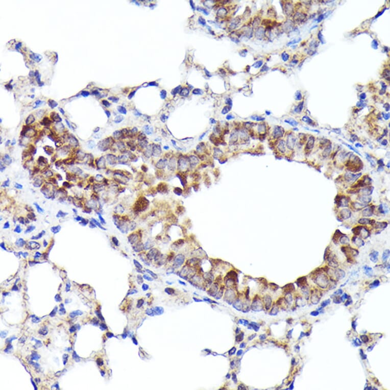 Immunohistochemistry - Anti-BNIP3L/NIX Antibody (A15147) - Antibodies.com
