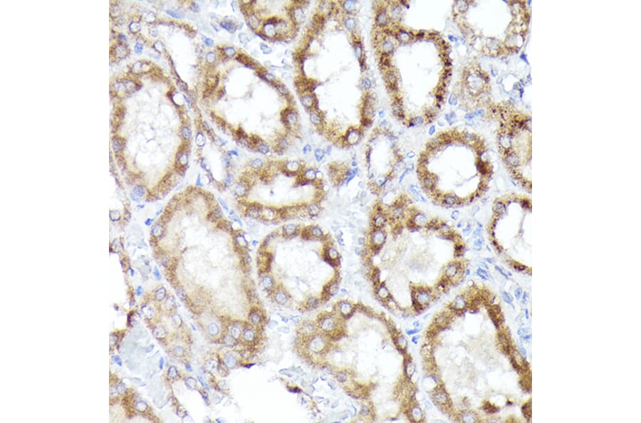 Immunohistochemistry - Anti-BNIP3L/NIX Antibody (A15147) - Antibodies.com